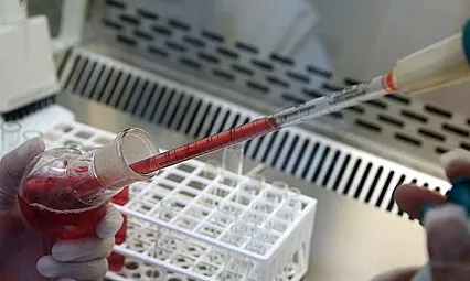 Kansere Yakalanma Riski En Yüksek Olan Kan Grubu Açıklandı