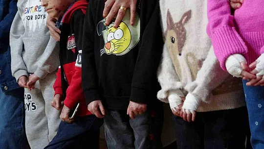 Diyarbakır'da memurun yazışma hatası nedeniyle 20 kelebek hastasının boğaz ameliyatı ertelendi