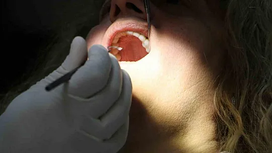 Uzmanı implant tedavisi sonrası yapılması gerekenleri anlattı