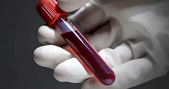 En Sağlıklı Kan Grubu Açıklandı! Bilim İnsanları 0 Kan Grubuna Dikkat Çekiyor