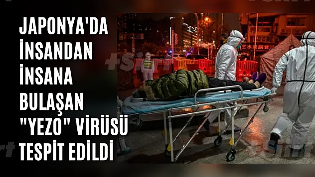 Japonya'da insandan insana bulaşan 'Yezo' virüsü tespit edildi