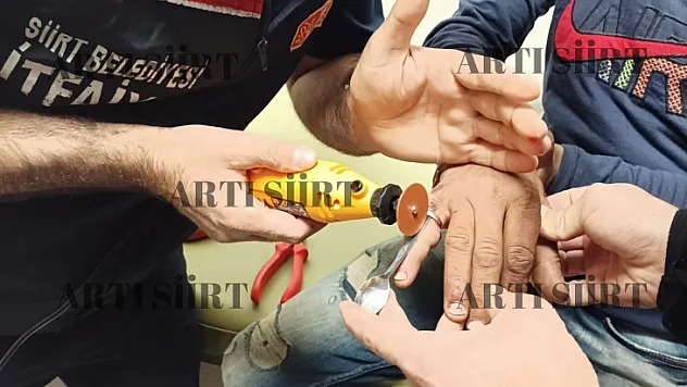 Siirt'te Parmağına Yüzük Sıkışan Genci İtfaiye Ekipleri Kurtardı