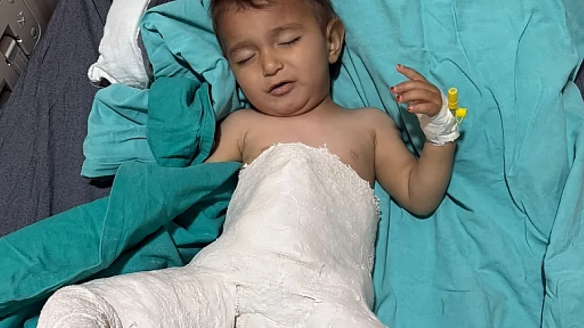 Siirt'te 15 Aylık Bebek, Başarılı Kalça Çıkığı Ameliyatıyla Sağlığına Kavuştu